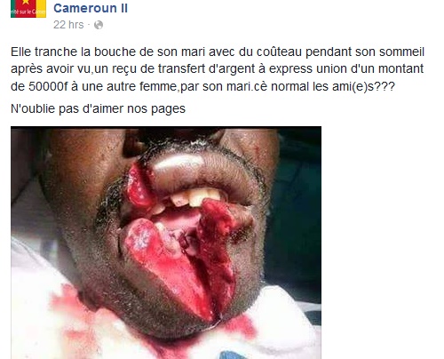 OMG! See What a Jealous Wife Did to Her Husband for Cheating on her [GRAPHIC PHOTO] 10