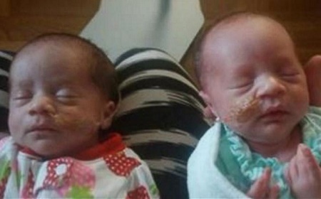 WOW: 20 Year Old Woman Gives Birth to Three Sets of Twins in 26 Months (Photos) 2
