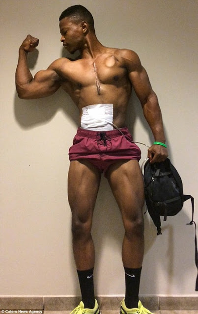 Meet The 26-year-old Bodybuilder Who Carries His Heart in a Backpack (Photos) 2