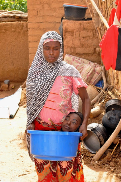 Meet the Girl Born With No Arms or Legs Who Lives in a Plastic Bowl (Photos) 2