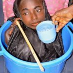 Meet the Girl Born With No Arms or Legs Who Lives in a Plastic Bowl (Photos) 4