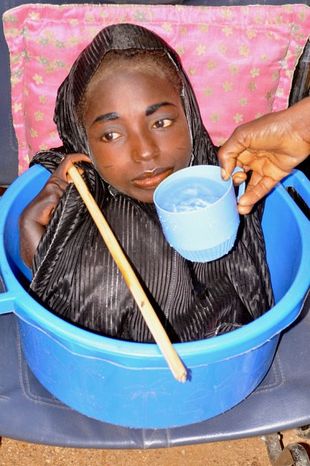 Meet the Girl Born With No Arms or Legs Who Lives in a Plastic Bowl (Photos) 3