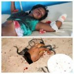 Husband Cuts Off His Wife's Hand for Cheating on Him (Graphic Photo) 15