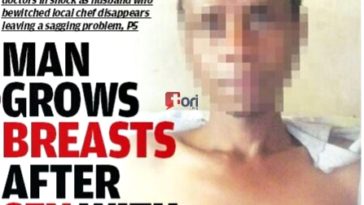 Man Grows Breasts After Having Illicit Sex with a Neighbor's Wife...See Shocking Details (Photos) 5
