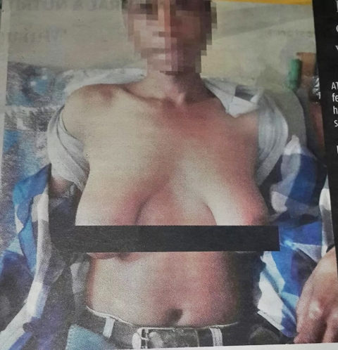 Man Grows Breasts After Having Illicit Sex with a Neighbor's Wife...See Shocking Details (Photos) 3