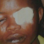 SHOCKING: Woman Bites Off Her Friend’s Eyelid During A Fight In Lagos 8