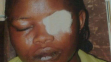 SHOCKING: Woman Bites Off Her Friend’s Eyelid During A Fight In Lagos 1