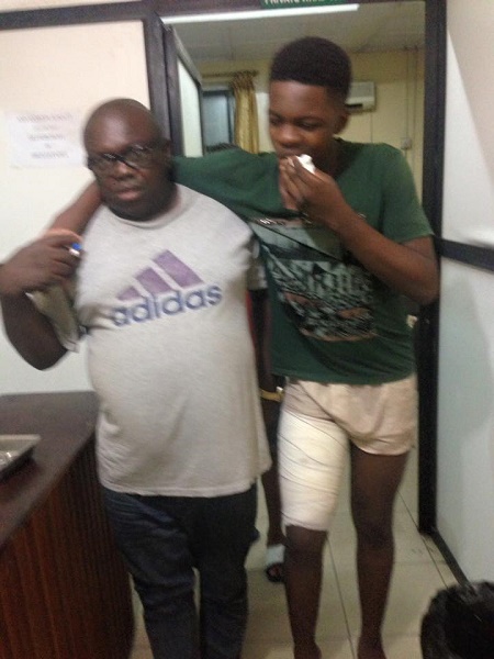 Father Narrates How His Son Survived a 4400kv Electric Shock from an Exposed Armoured Cable in Lagos (Photos) 1