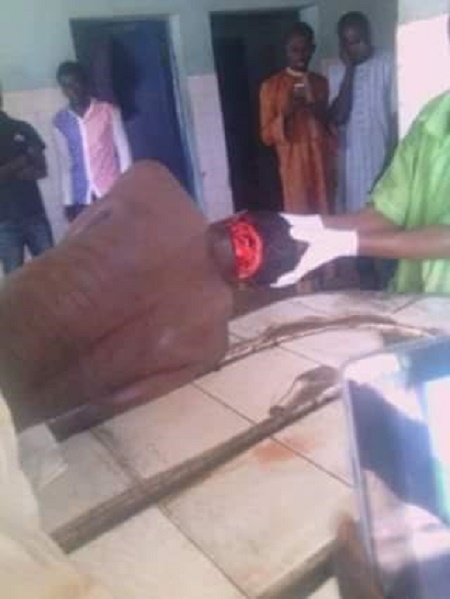 Armed Robbers Slit Keke Driver's Neck in Kano (Very Graphic Photos) 2