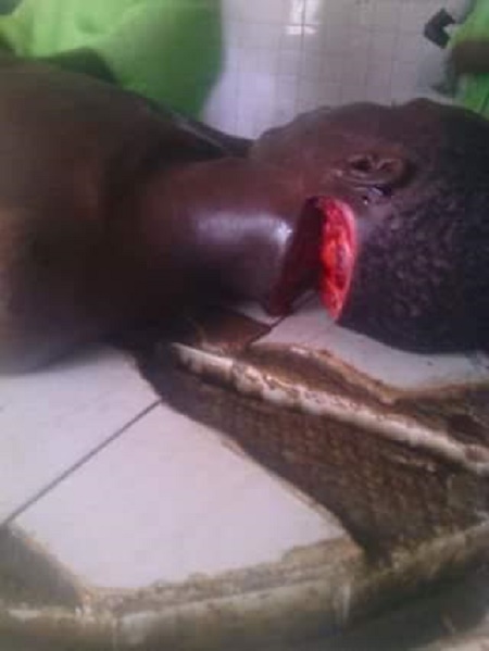 Armed Robbers Slit Keke Driver's Neck in Kano (Very Graphic Photos) 3