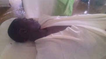 Armed Robbers Slit Keke Driver's Neck in Kano (Very Graphic Photos) 5