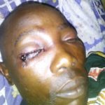 FRSC Official Whose Eye was Plucked Out By Soldiers Begs for Justice [PHOTOS + VIDEO] 13