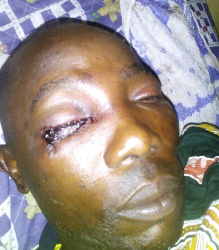 FRSC Official Whose Eye was Plucked Out By Soldiers Begs for Justice [PHOTOS + VIDEO] 15