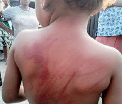 What a Father Did to His 4-year-old Daughter for Losing Her Slippers Will Shock You (Photo) 6