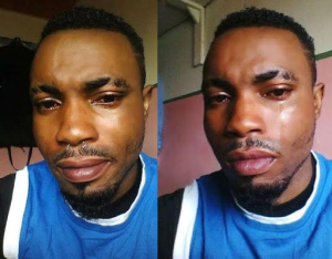 Man shares photos of himself crying over a girl who hurt his feelings 1