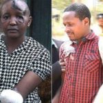 Man Cuts Off His Wife's Hands for Not Getting Pregnant 7 Years After Marriage [PHOTOS] 2