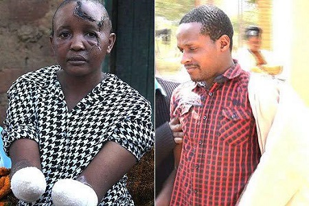 Man Cuts Off His Wife's Hands for Not Getting Pregnant 7 Years After Marriage [PHOTOS] 7