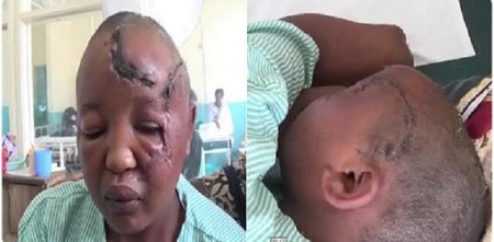 Man Cuts Off His Wife's Hands for Not Getting Pregnant 7 Years After Marriage [PHOTOS] 3