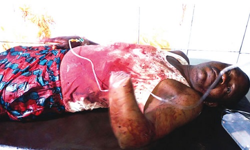 Man Chops Off Brother's Hand with Cutlass Over Land Dispute (Photo) 1