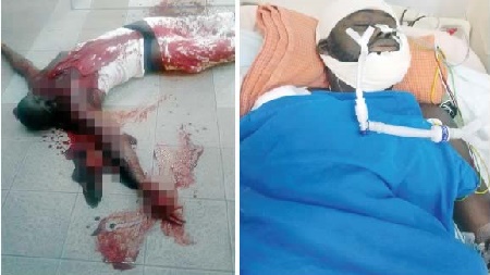 Cultists hack Nigerian Man with swords in Malaysia [GRAPHIC PHOTO] 9