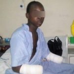 17-year-old Boy's Hand Chopped Off After He Was Caught Stealing Medicinal Plant 13