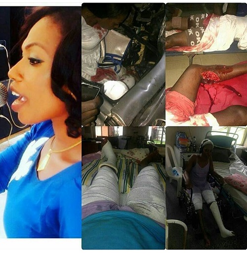 Nigerian Artiste Funke Gold Whose Leg was Crushed by Dangote Truck Begs for Justice (Photos) 2