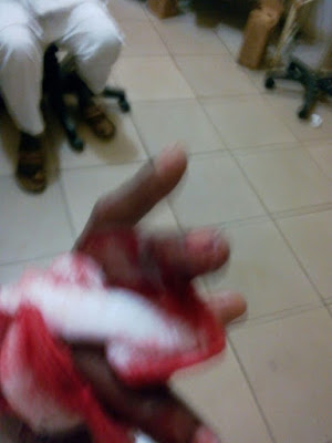 PR and Fashion Consultant Priscilla Philips Robbed and Injured in Abuja [PHOTOS] 15