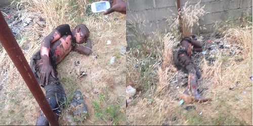 Badly Burnt Transformer Thief Arrested After Surviving Electrocution [PHOTOS] 1