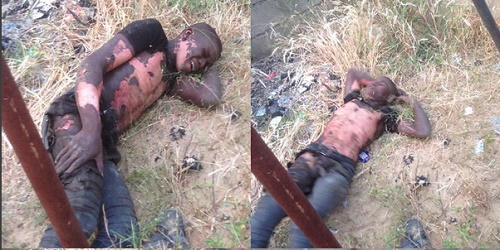 Badly Burnt Transformer Thief Arrested After Surviving Electrocution [PHOTOS] 2