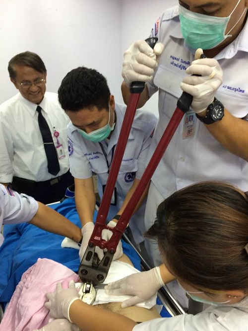 Doctors Use Bolt Cutters & Saw to Remove Cock-Ring Stuck on a Man's P*nis [PHOTOS] 1