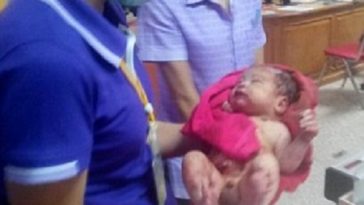 Baby Stabbed 14 Times & Buried, Rescued Alive [PHOTOS] 3