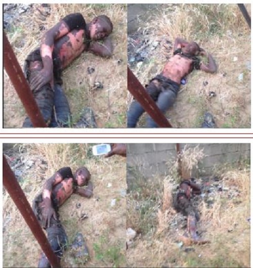 Badly Burnt Transformer Thief Arrested After Surviving Electrocution [PHOTOS] 3