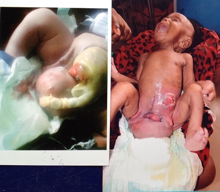 SEE the Baby Born Without Anus and Private Parts in Onitsha, Doctors Cant Say If It's A Boy Or Girl [PHOTOS] 2