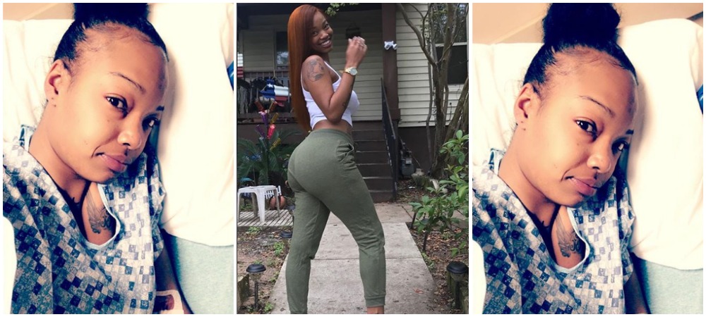 "Love Yourself" - Model Tells Ladies As She Cries And Battle For Her Life After Bad Bum Enlargement 2