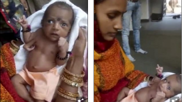 Baby Born With Three Hands Worshipped As A God In India [Photos/Video] 9