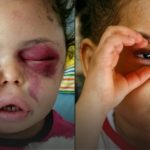 Meet The Young Girl Whose Tragic Story Makes Her Symbol Of Yemen War 2