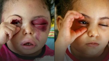 Meet The Young Girl Whose Tragic Story Makes Her Symbol Of Yemen War 5