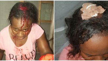 Man Brutally Attack And Break Wife's Head After She Allegedly Caught Him Cheating [Graphic Photos] 12