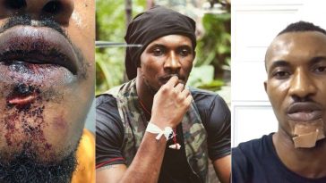 Watch Video Where Gideon Okeke Had A Face-off With The Police That Resulted To His Injury 2