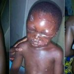 Heartless Woman On The Run After Inflicting Horrific Injury On Her Young Stepson In Edo State - See Photos 12