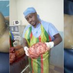See What Doctor Removed From A Woman Who Appeared Pregnant [Graphic Photos] 11