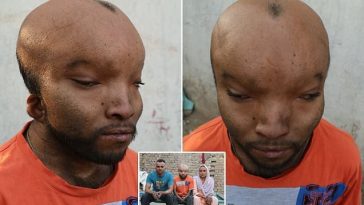 Man Cruelly Nicknamed 'Alien' Because Of His Head Cries Out That He Can't Find Love [Photos] 6