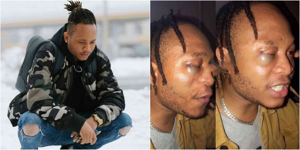 YBNL's Viktoh Beaten To Pulp By Nigeria Police Men On His Way To Concert [Photos/Video] 11