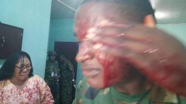 Wife of Air Commodore Attempts To Butcher Officer To Death For Disciplining Her Daughter In school 5