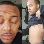 Bow Wow Shares Photos Of Injury Sustained From Fight With Girlfriend 8