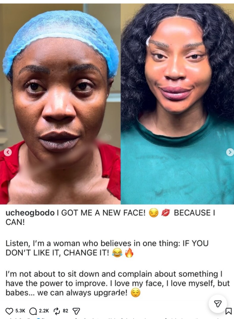 Actress Uche Ogbodo Show Off Her ‘New Face’ After Non-Surgical Procedure 6 Actress Uche Ogbodo Show Off Her ‘New Face’ After Non-Surgical Procedure
