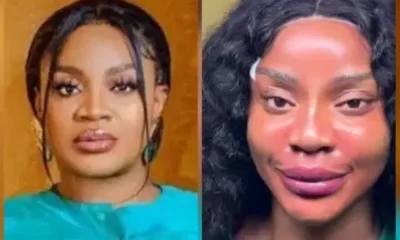Actress Uche Ogbodo Show Off Her ‘New Face’ After Non-Surgical Procedure