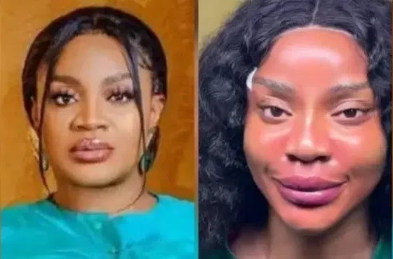 Actress Uche Ogbodo Show Off Her ‘New Face’ After Non-Surgical Procedure