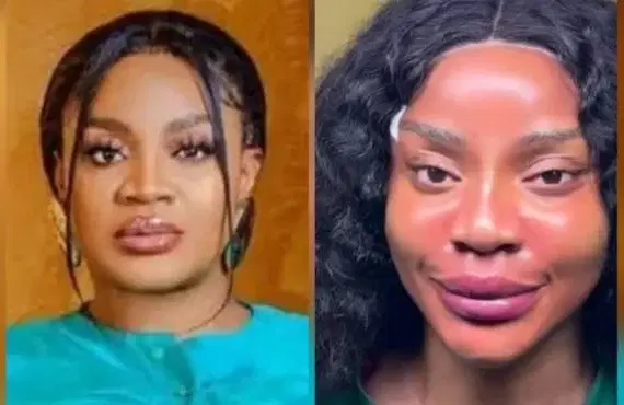 Actress Uche Ogbodo Show Off Her ‘New Face’ After Non-Surgical Procedure 5 Actress Uche Ogbodo Show Off Her ‘New Face’ After Non-Surgical Procedure